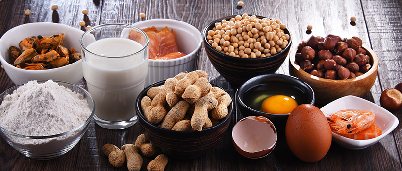 Selection of popular foods related to allergens