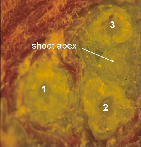 Bud analysis taken from a microscope