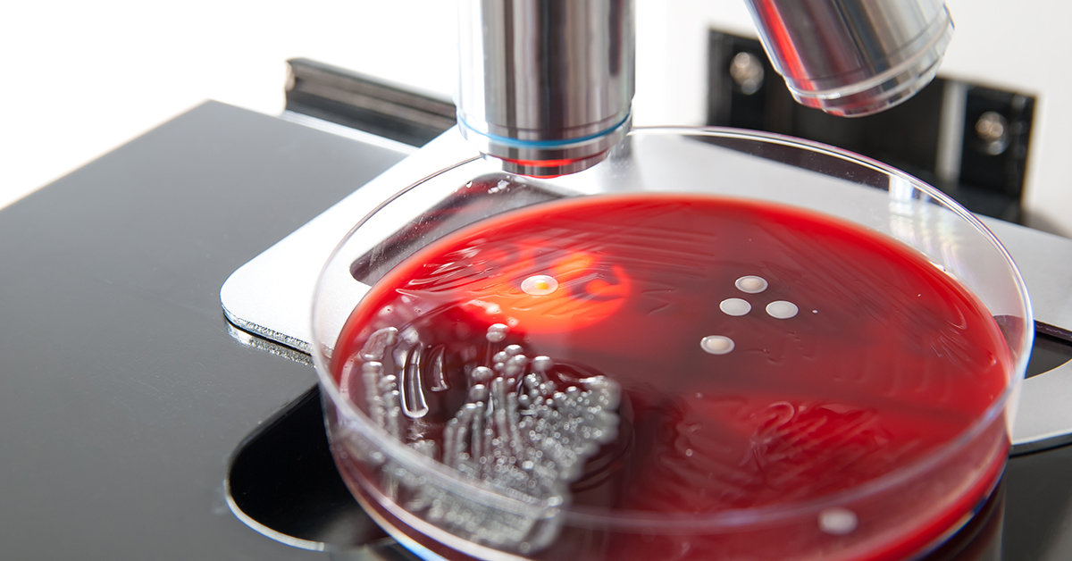 Agar plate with bacteria growth under microscope