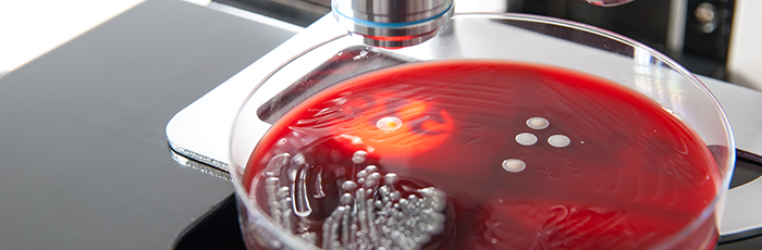 Agar plate with bacteria growth under microscope