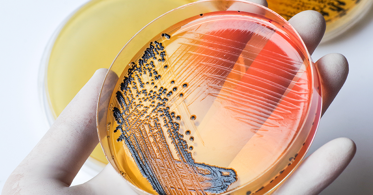 Scientist holding agar plate with Salmonella growing inside