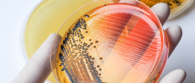 Agar plate with salmonella growth