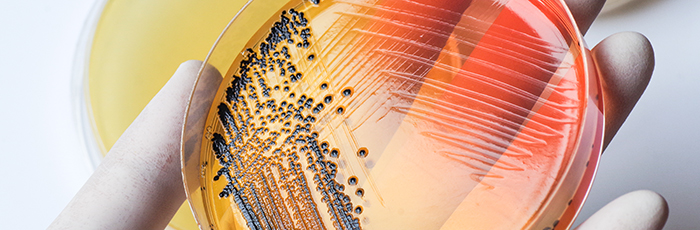 Agar plate with salmonella growth