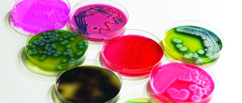 Agar plates