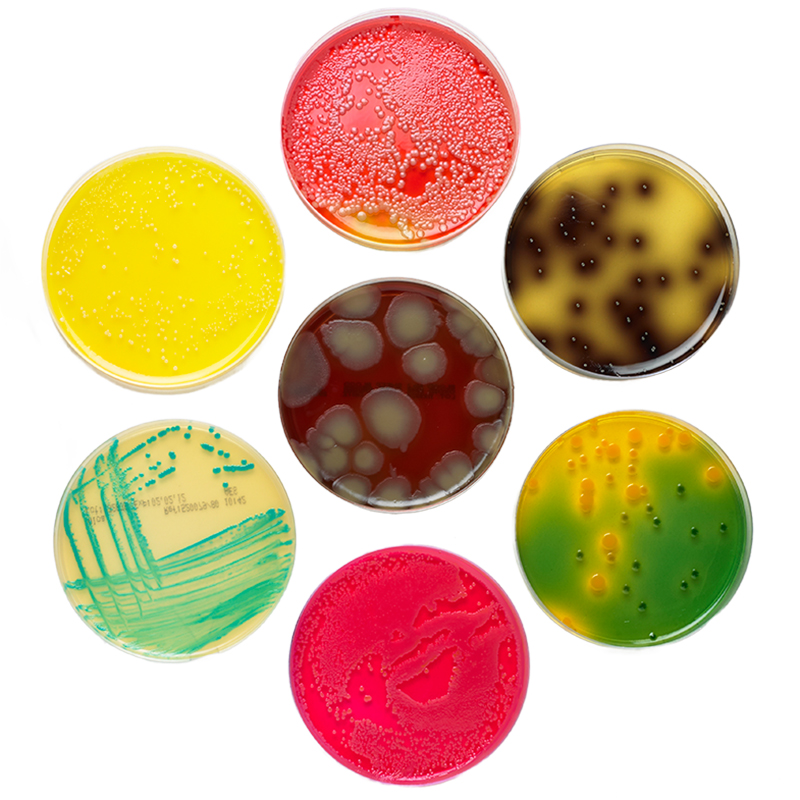 agar plates with pathogens