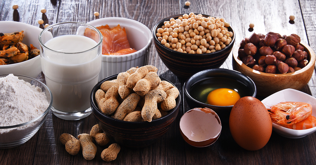 Selection of common foods related to allergies