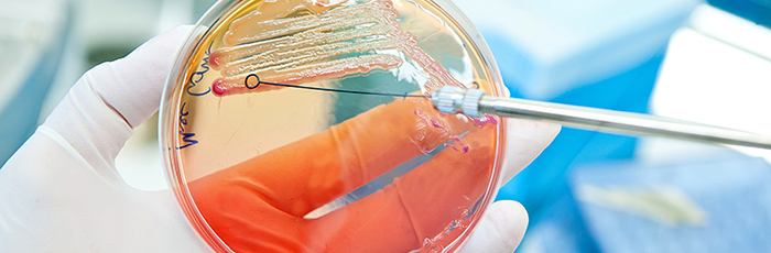 E. coli growth being scraped on an agar plate