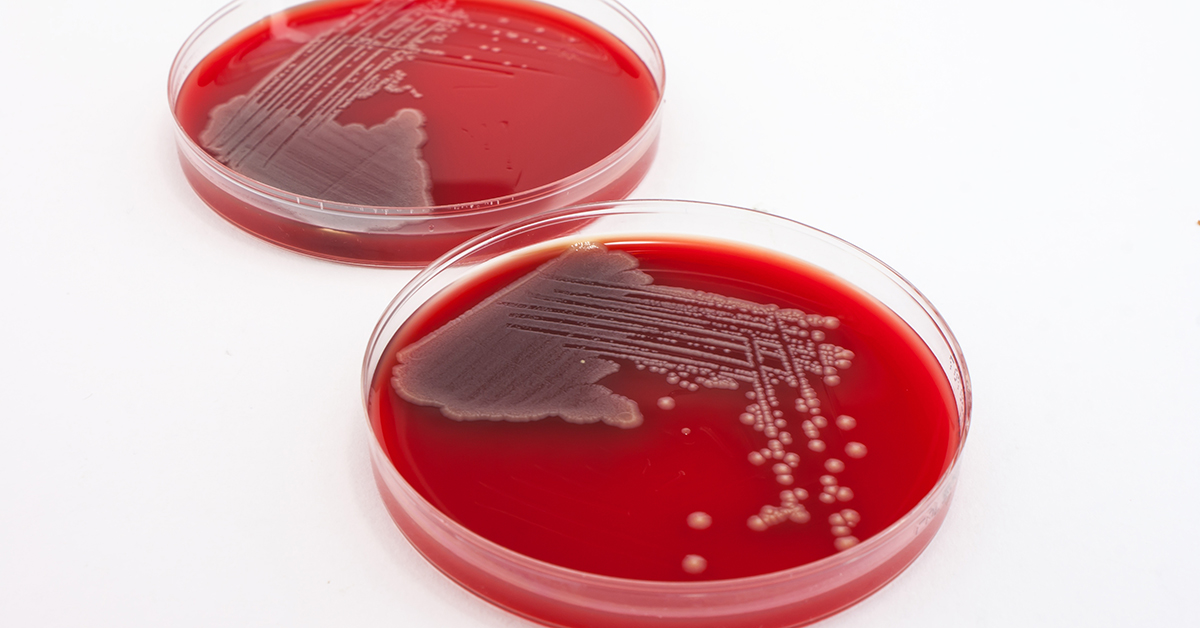 E.coli growth in agar plates