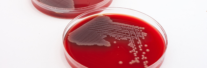 E.coli growth in agar plates