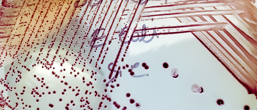 E. coli growth on an agar plate