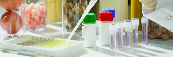 Allergen testing in laboratory