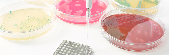 Microbial growth in agar plates on worktop