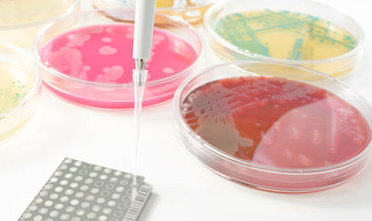 Rapid microbiological methods 