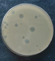 Agar plate with bacteria growth