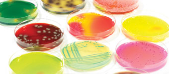 Microbiological effects of food processing