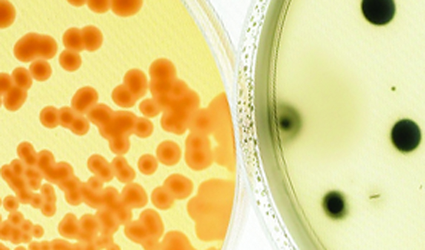 Agar plates