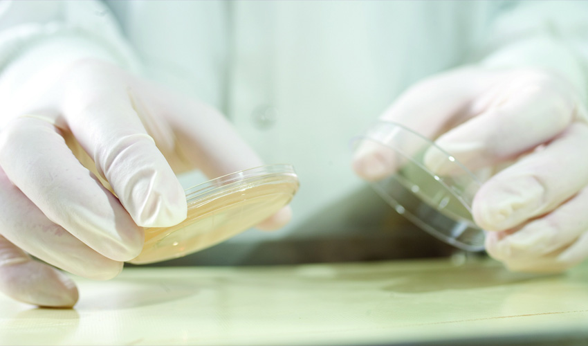 Scientist with agar plates