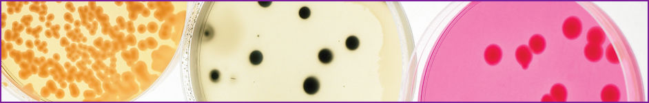 High pressure process (HPP) challenge testing